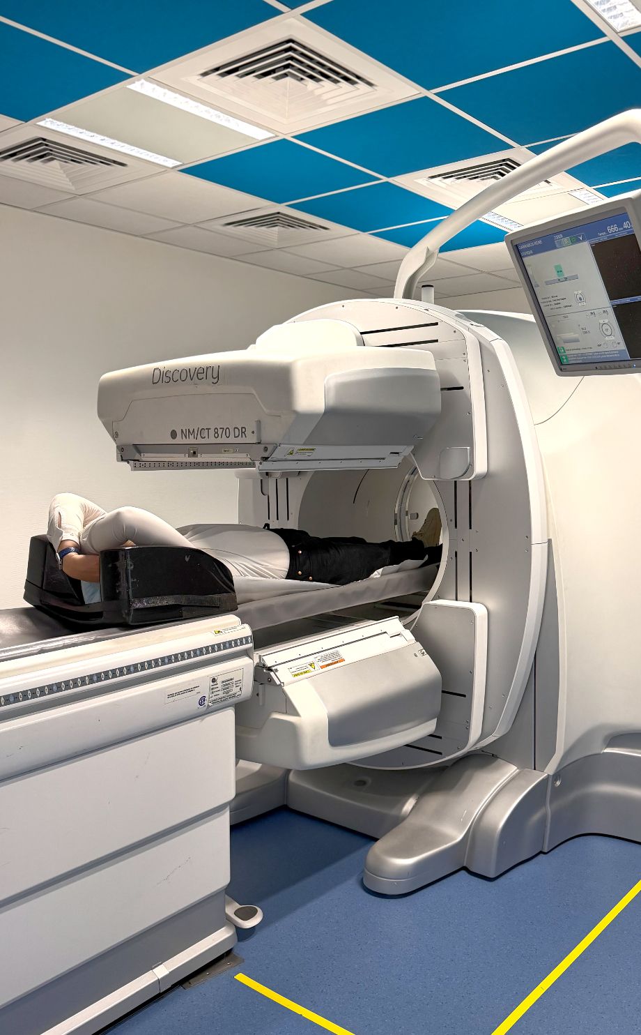  CAMERA DE SCINTIGRAPHIE